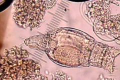 Bdelloidea_Rotifero_2.jpg